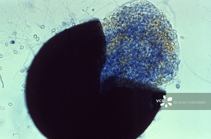 博伊德假阿利什霉的子囊果，光学显微照片图片素材