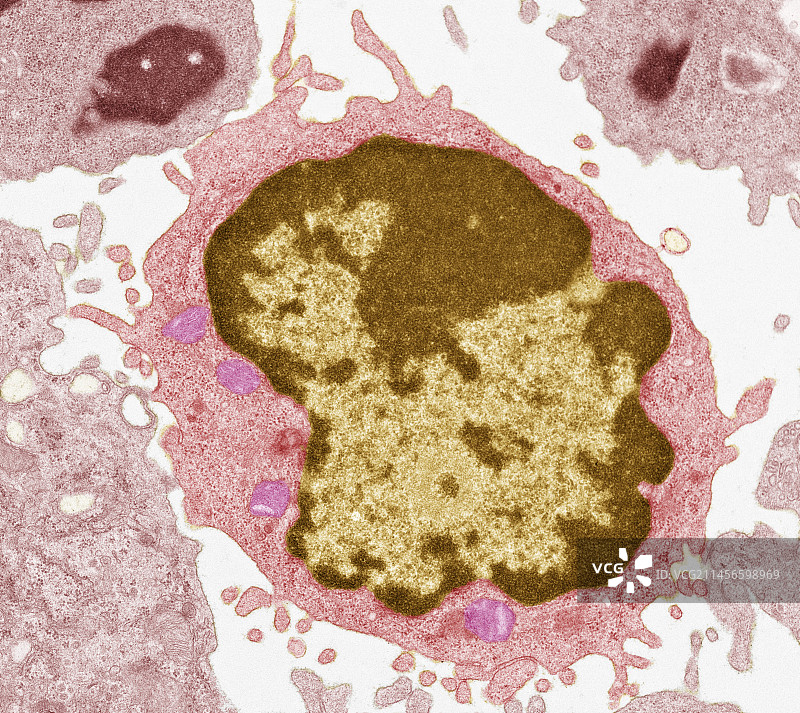 大型淋巴细胞TEM图图片素材