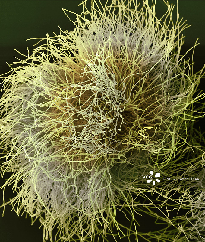 红色毛癣菌真菌扫描电镜图图片素材