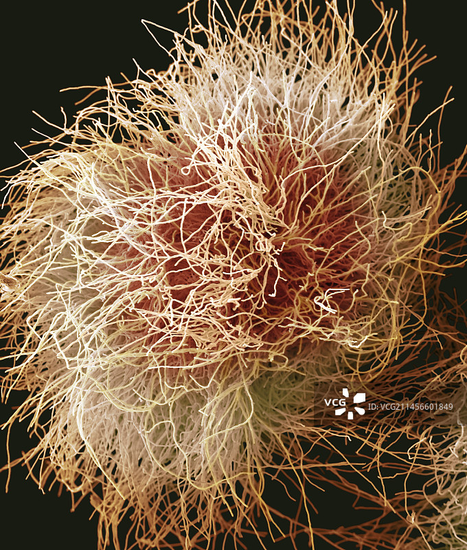 红色毛癣菌真菌扫描电镜图图片素材