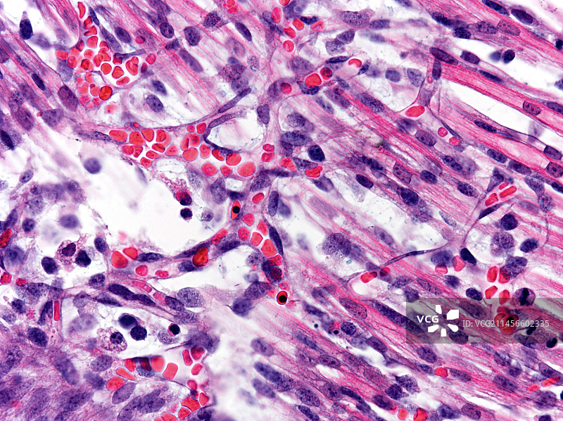 毛细血管，光学显微照片图片素材