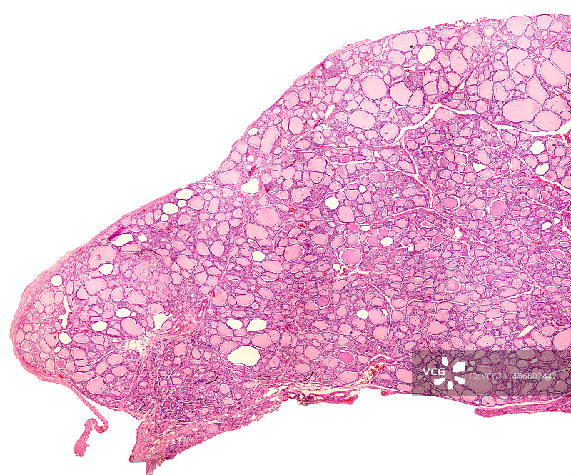 人的甲状腺显微照片图片素材