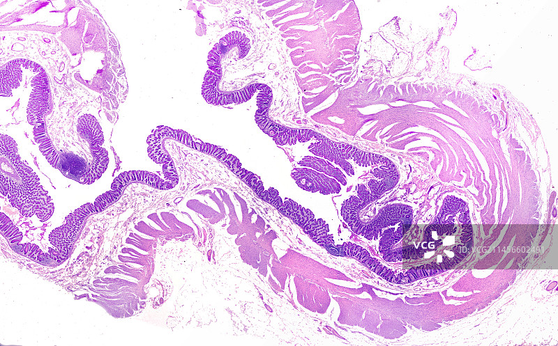 人结肠显微照片图片素材
