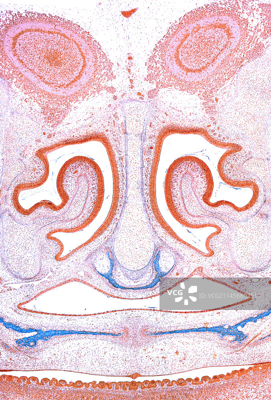 兔子胎儿头部显微照片图片素材