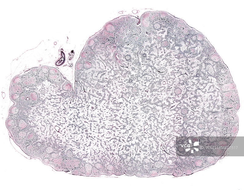 淋巴结中的网状纤维，光学显微照片图片素材