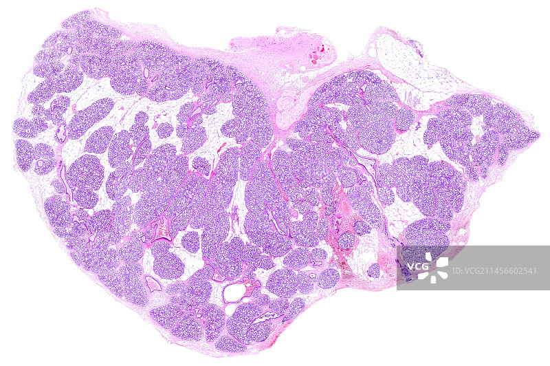 怀孕的乳房，光学显微照片图片素材