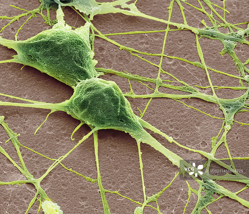 神经元扫描电镜图图片素材