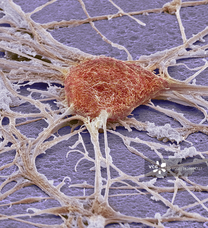 神经元扫描电镜图图片素材