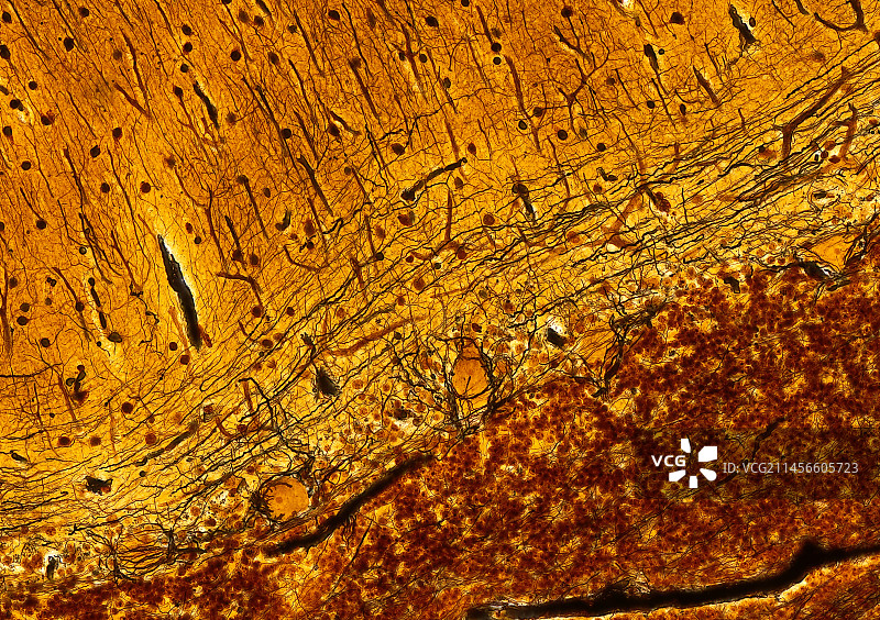 脑部显微照片图片素材