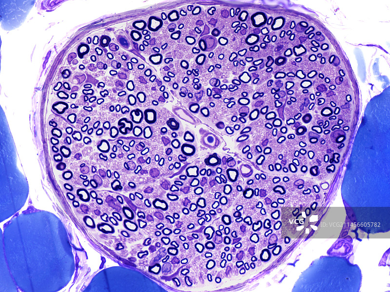 神经组织显微照片图片素材