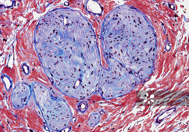 神经组织显微照片图片素材