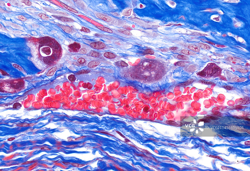 血管显微照片图片素材