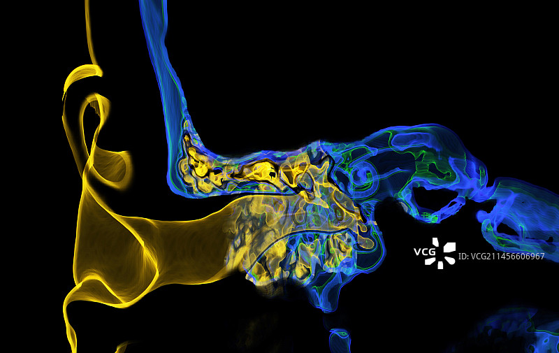 人耳3D CT扫描图片素材