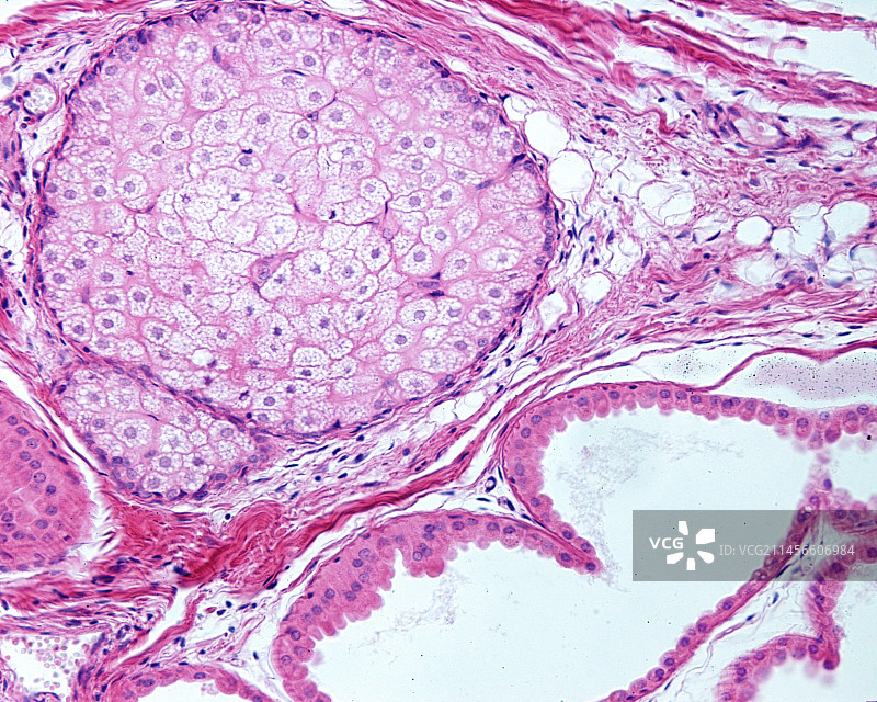 皮脂腺和顶泌汗腺显微照片图片素材