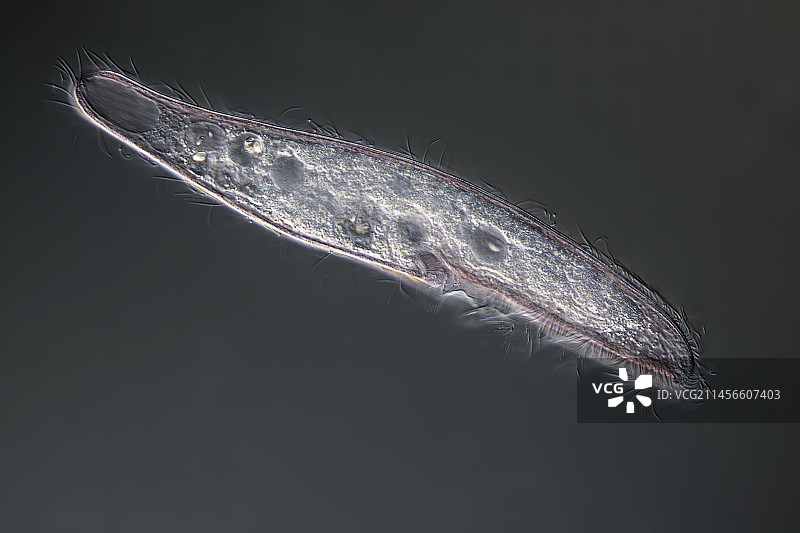 美洲喇叭虫原生动物显微照片图片素材