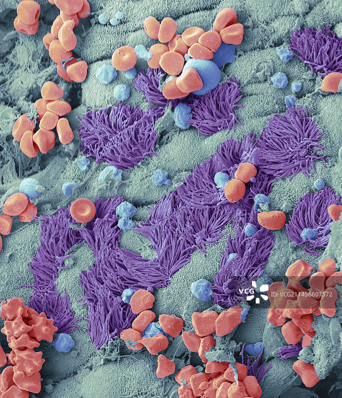 输卵管积血，扫描电镜图片素材