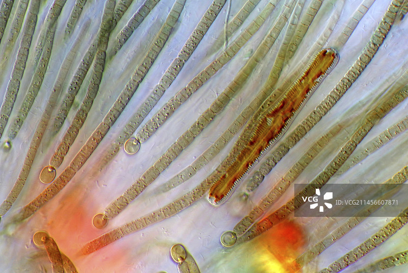 Rivularia蓝细菌和硅藻的显微照片图片素材