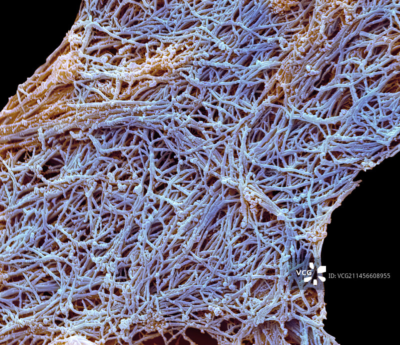 胶原纤维扫描电镜图图片素材