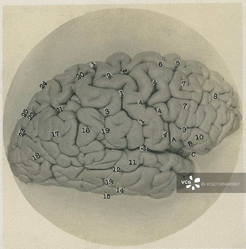 人类的大脑图片素材