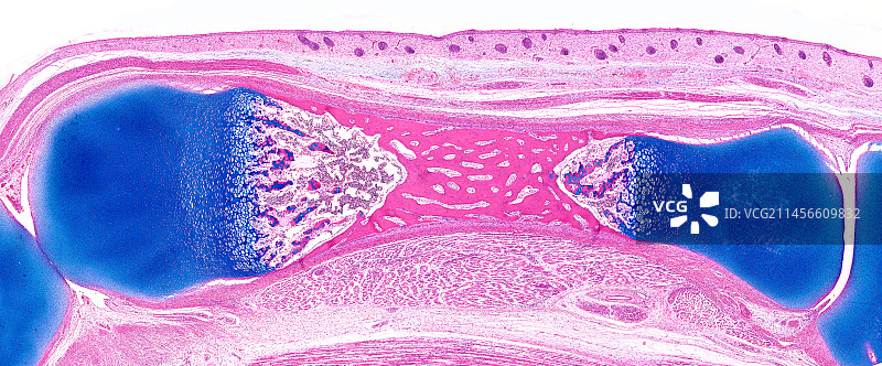 骨骼生长光学显微照片图片素材