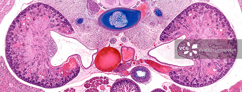 肾脏显微照片图片素材