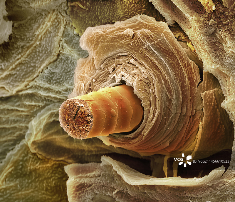 毛囊，扫描电子显微镜图片素材