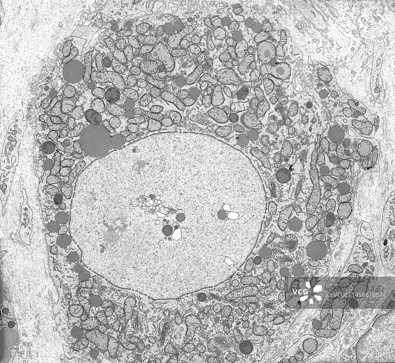 黄体细胞，TEM图片素材