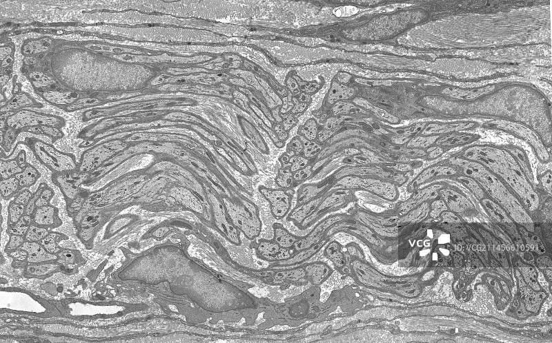 神经透射电镜图片素材