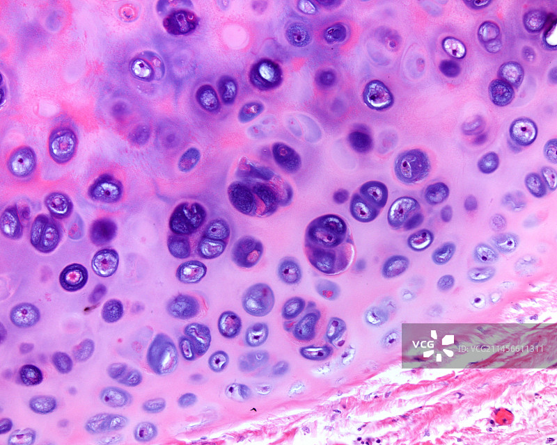 透明软骨中的同源群，光学显微照片图片素材