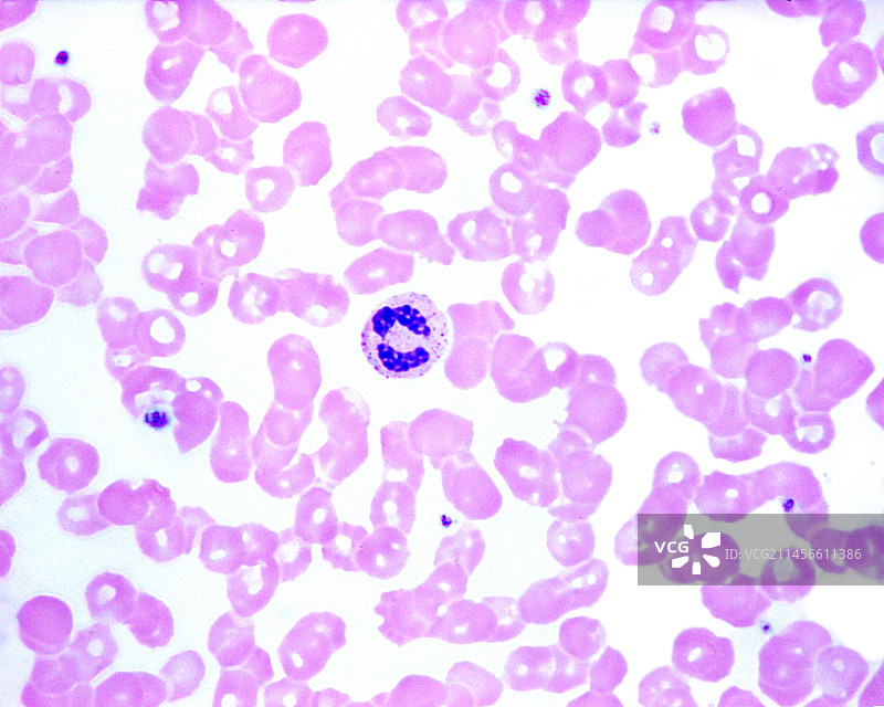 含中性粒细胞的人类血涂片显微照片图片素材