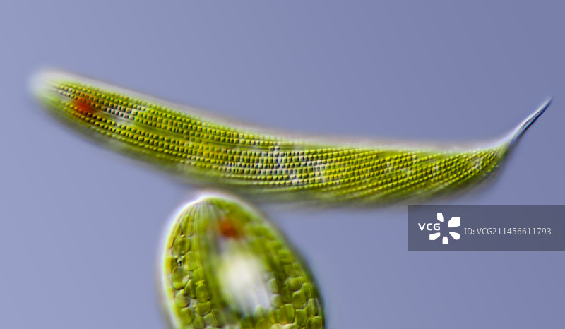 囊泡藻和筒渊藻淡水原生生物显微照片图片素材
