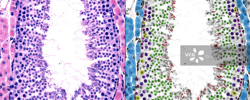 曲细精管和莱迪格细胞，光学显微照片图片素材