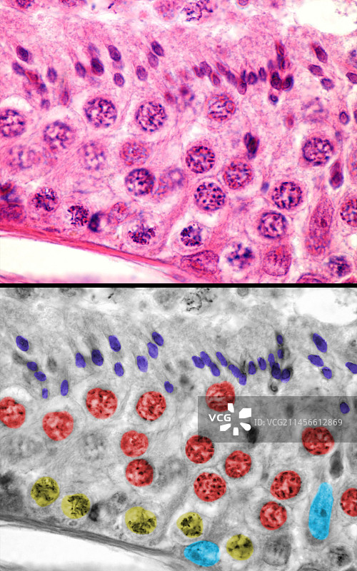人类睾丸中的精子发生，光学显微照片图片素材