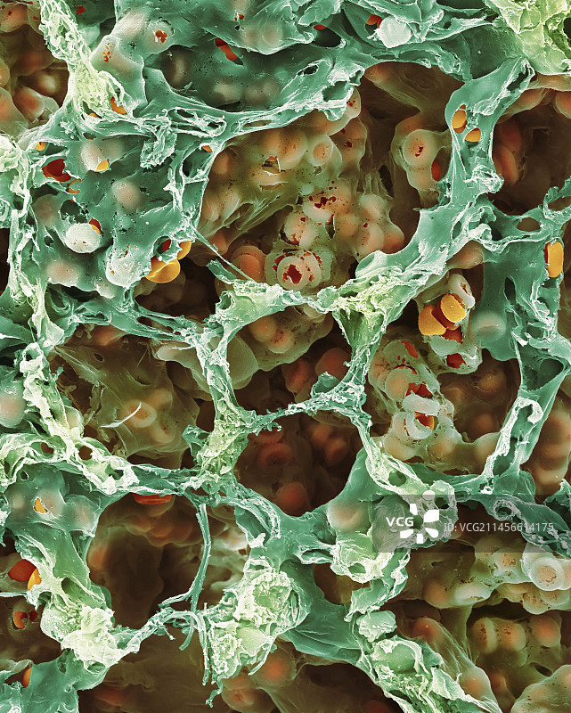 肺组织扫描电镜图图片素材