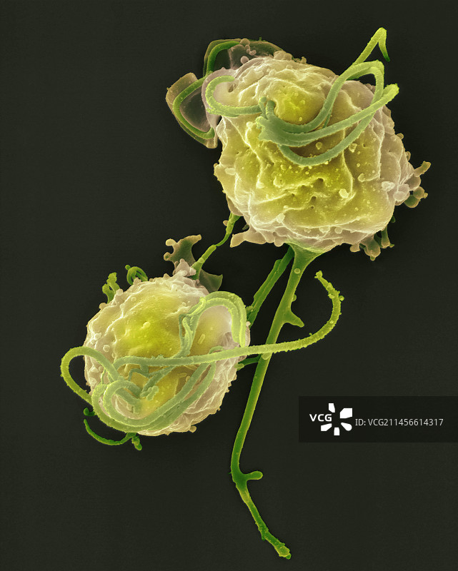 受感染的按蚊中肠扫描电镜图图片素材