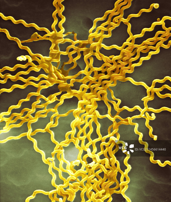 问号钩端螺旋体细菌（扫描电镜图）图片素材