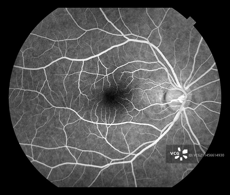 健康的眼睛，血管造影图片素材