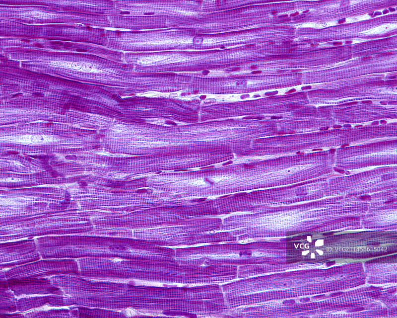 心脏心肌中的闰盘，光学显微照片图片素材