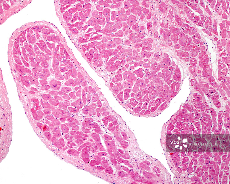 人类心脏心内膜显微照片图片素材