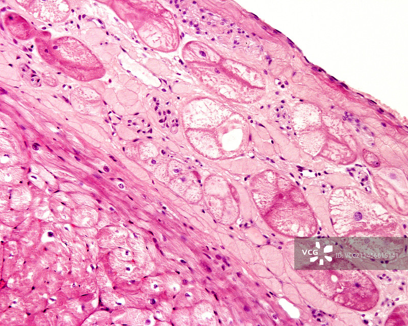 心脏中的浦肯野纤维，光学显微照片图片素材