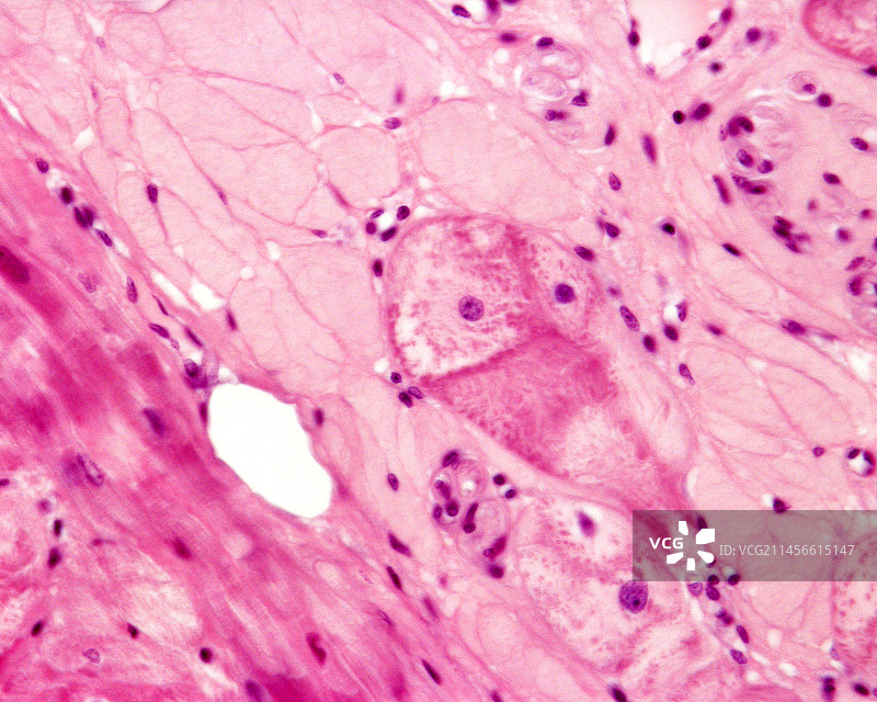 心脏中的浦肯野纤维，光学显微照片图片素材