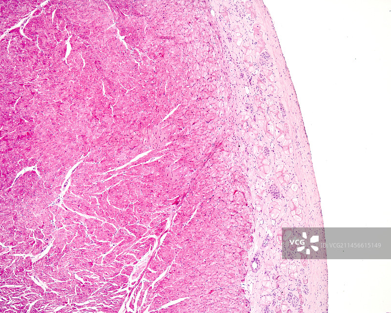 心脏中的浦肯野纤维，光学显微照片图片素材