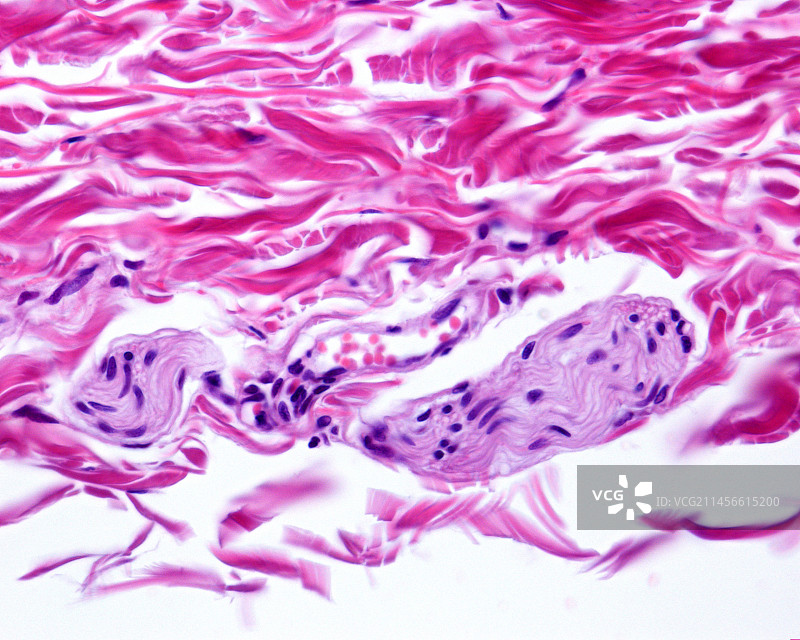 静脉外膜显微照片图片素材