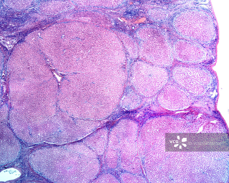 中国和巴基斯坦边境上的卷积云图片素材