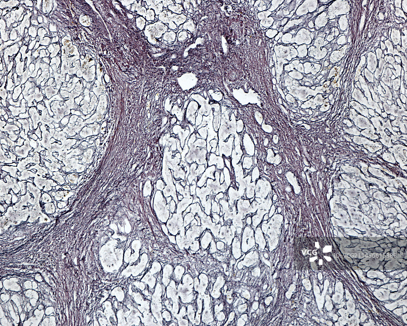 中国和巴基斯坦边境上的卷积云图片素材