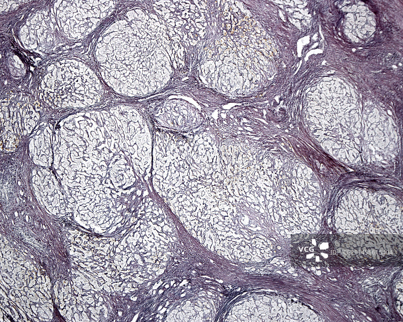 中国和巴基斯坦边境上的卷积云图片素材