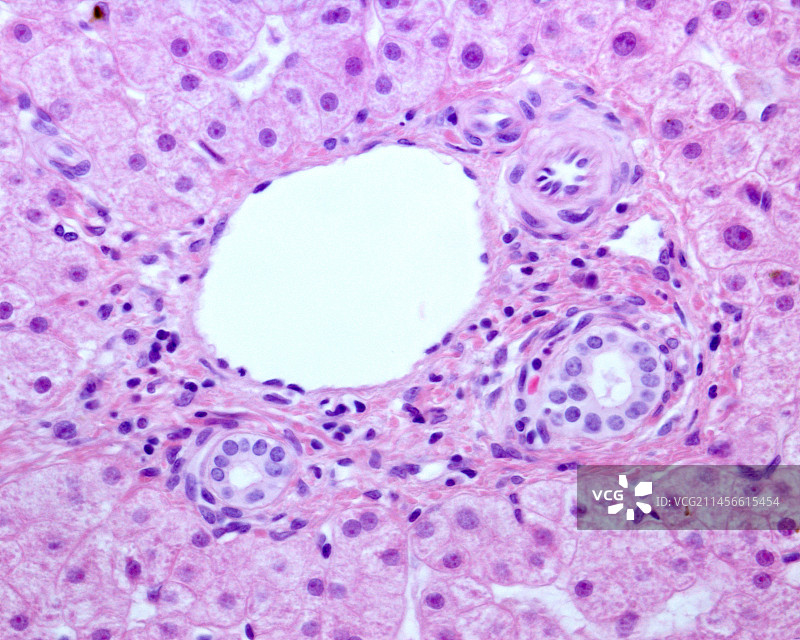 人肝门区光显微照片图片素材