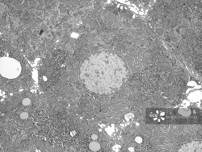 肝脏，TEM图片素材