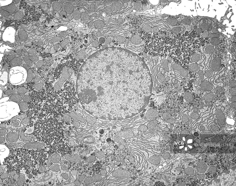 肝脏，TEM图片素材