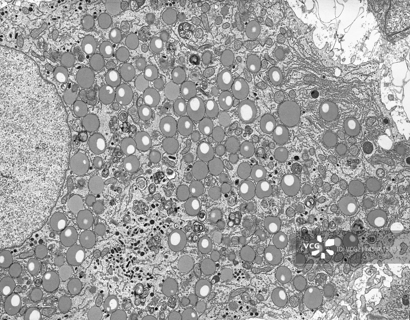 黄体，TEM图片素材